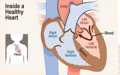 Two diagrams show the position of the heart in the body and a close-up, cross section of a healthy heart. Blood flows from the left atrium into the left ventricle and through a valve into the aorta. 