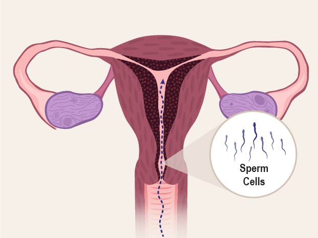 Picture shows sperm cells entering the uterus through the vaginal opening. 